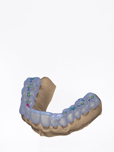 ChairsideCAD - Modulo Bite Splint